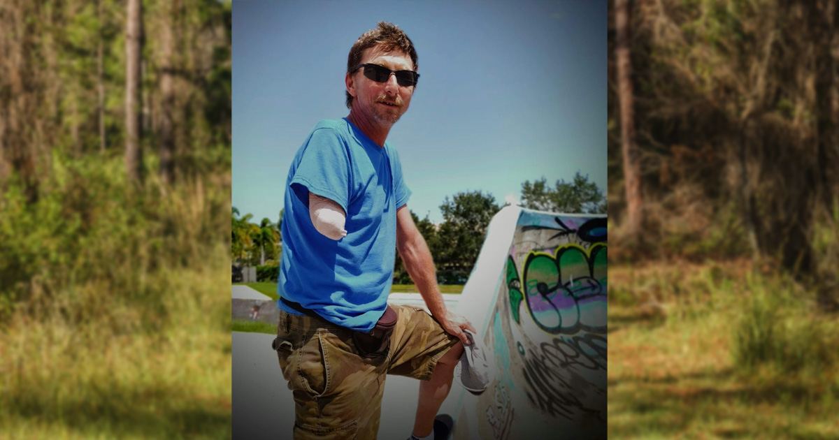 Florida Man Emerges Naked From Swamp After Gator Rips His Arm Off