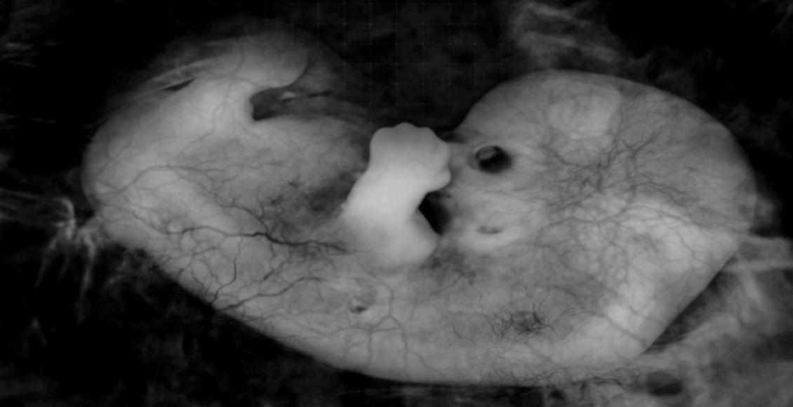 Abortion Clinic Fights Waiting Period Fine